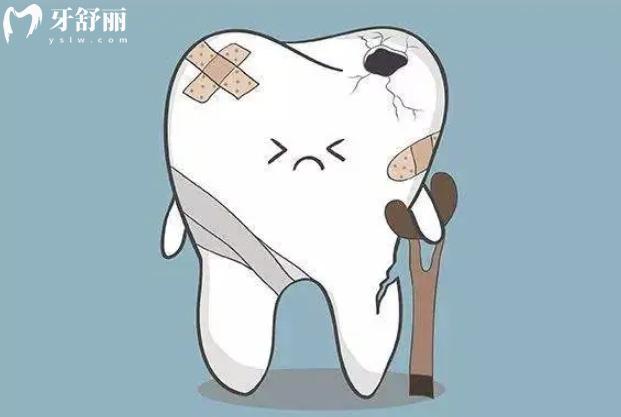 鄰面齲齒已經(jīng)有洞了怎么辦
