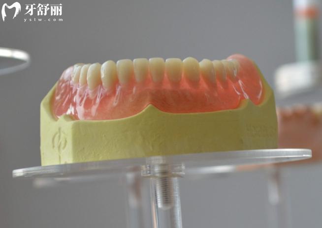 網(wǎng)上買的義齒可靠嗎