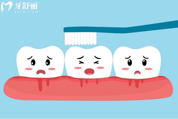 為什么刷牙總是出血？詳細介紹原因+預(yù)防+治療