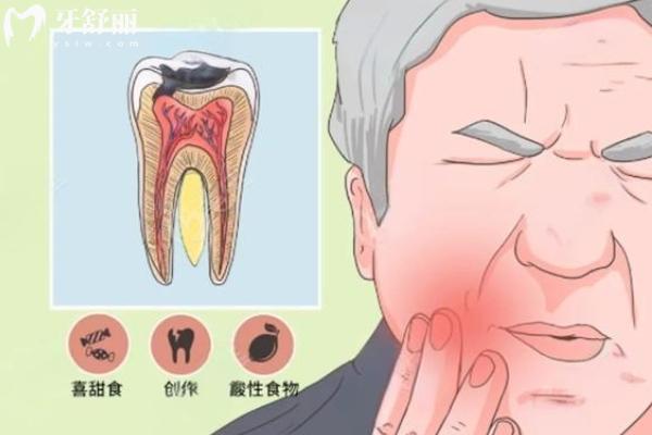 根尖周炎能自愈嗎？