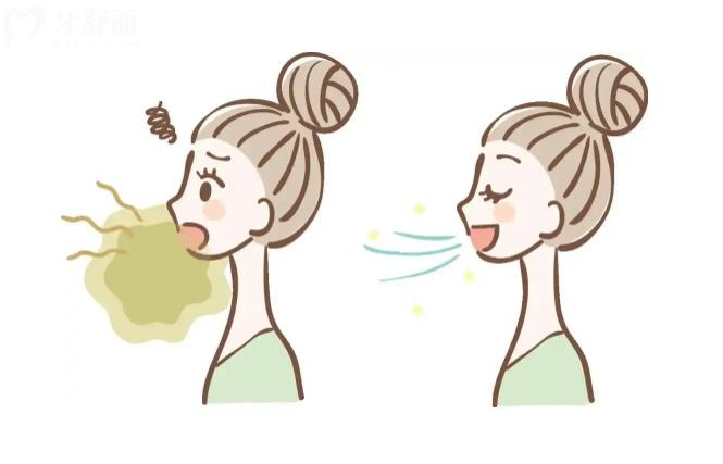 口臭的成因