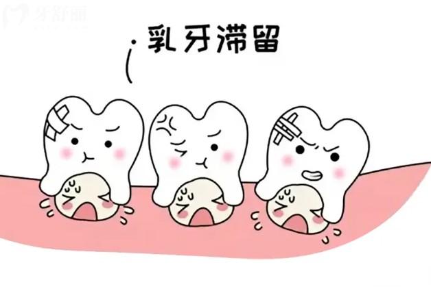 如何防止乳牙滯留