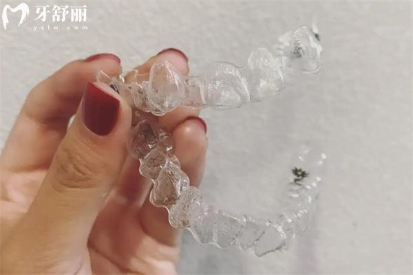 隱適美隱形矯正