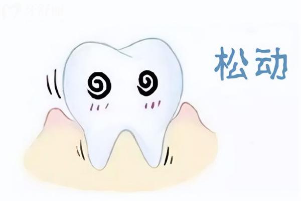 牙齒松動(dòng)固定修復(fù)圖片