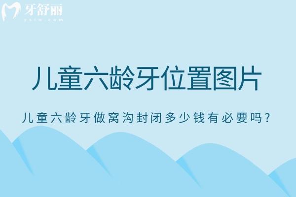 帶你了解兒童六齡牙位置圖片以及兒童六齡牙做窩溝封閉多少錢有必要嗎?