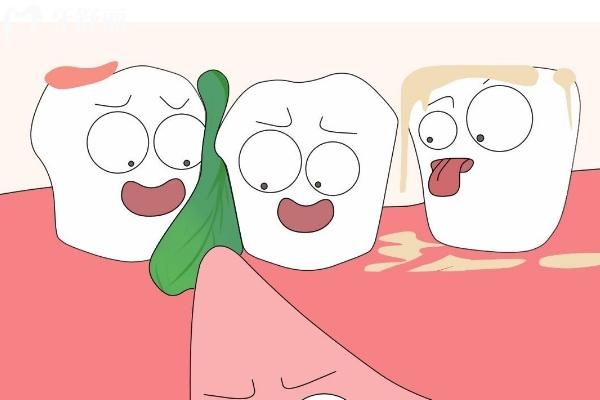 牙套吃啥塞啥！正畸期間該如何保持口腔衛(wèi)生