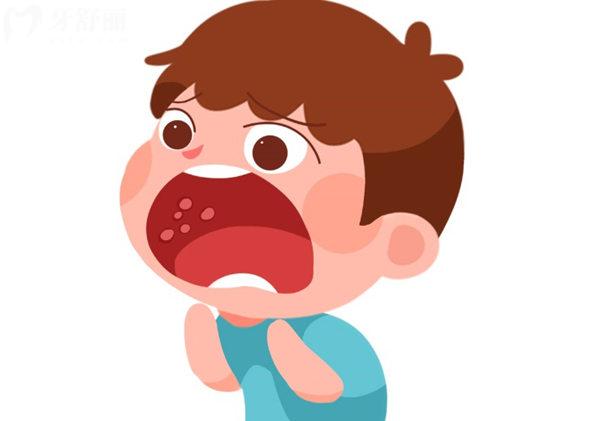 口腔潰瘍?cè)趺粗伪容^快比較有效