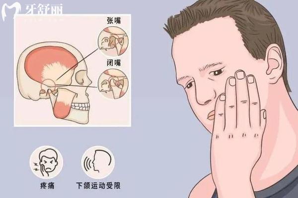 關(guān)節(jié)紊亂顳下頜可以自愈嗎