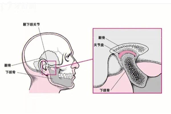 關(guān)節(jié)紊亂顳下頜可以自愈嗎