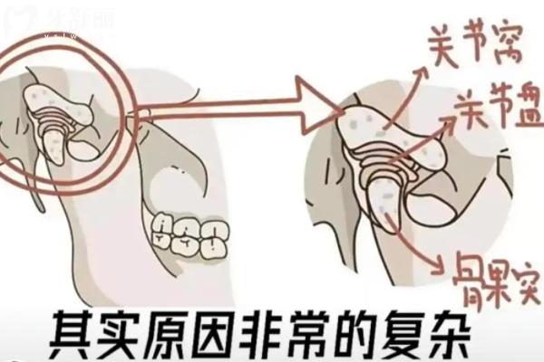 關(guān)節(jié)紊亂顳下頜可以自愈嗎