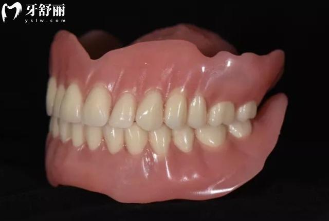 bps吸附性義齒是什么材料?從優(yōu)缺點(diǎn)/價(jià)格參考