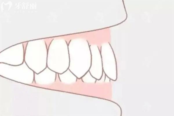 老掉牙不可信