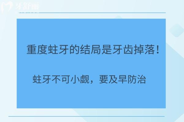 重度蛀牙的結(jié)局是牙齒掉落！蛀牙不可小覷，要及早防治