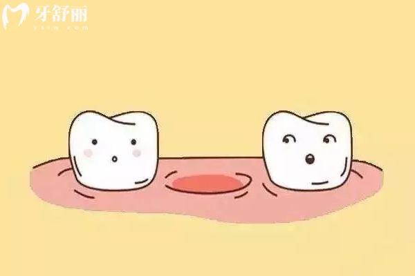 年輕恒牙脫位怎么辦？一文了解原因+并發(fā)癥+治療方法