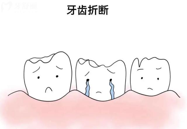牙齒被撞斷后怎么處理比較好