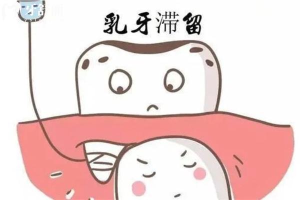 6歲小孩蛀牙洞千萬別補(bǔ)是誤區(qū)!良心醫(yī)生建議及時(shí)補(bǔ)牙家長注意啦!