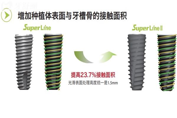 韓國登騰種植牙質(zhì)量怎么樣
