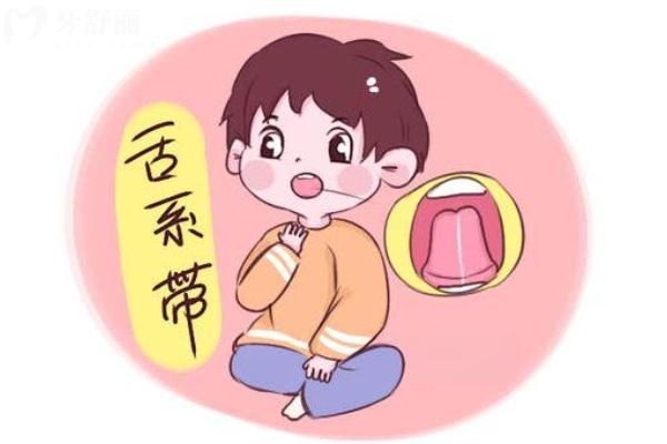 舌系帶矯正術(shù)