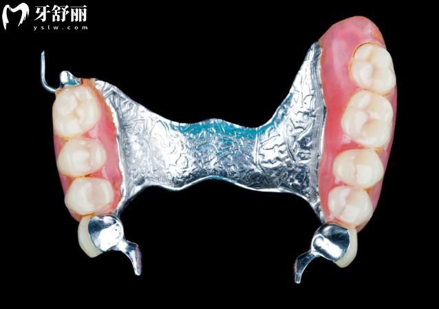 活動(dòng)假牙一般可以用幾年