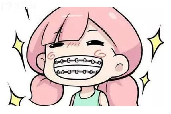 傳統(tǒng)金屬托槽矯正