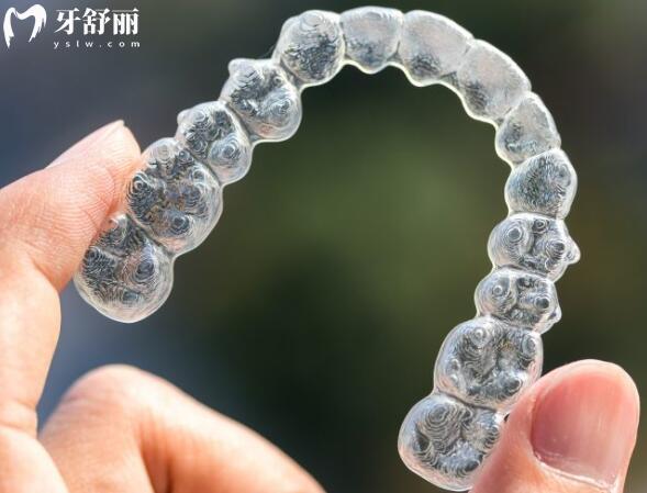 隱形矯正過(guò)程會(huì)遇見哪些問(wèn)題？牙套裂開、附件脫落等應(yīng)對(duì)策略在此