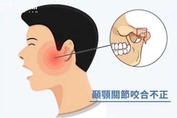 顳頜關節(jié)功能紊亂是什么？會影響口腔健康，預防至關重要