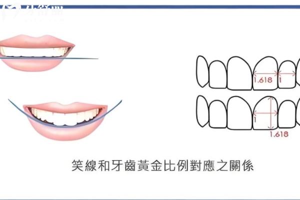 幾顆牙齒可以矯正嗎？