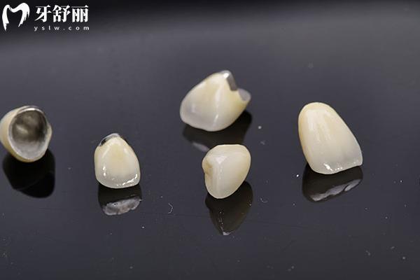 200塊的烤瓷能用嗎