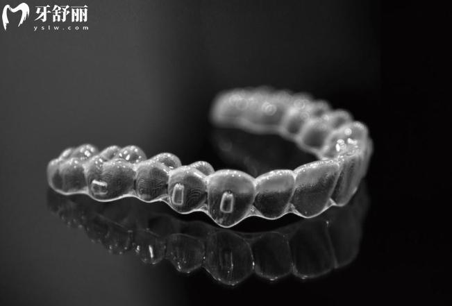 可麗爾隱形矯正好不好