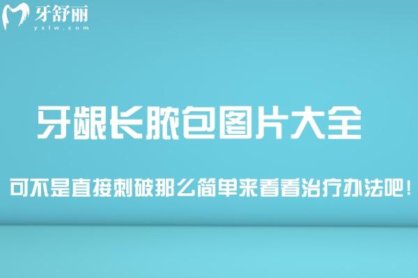牙齦長膿包圖片大全!可不是直接刺破那么簡單來看看治療辦法吧!