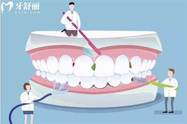 一般洗牙需要多長時(shí)間?多少錢?