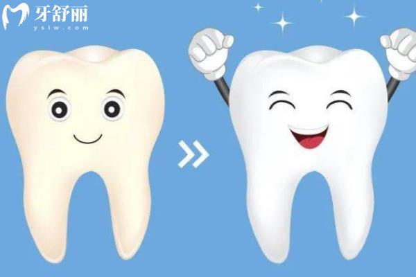 家庭美白和診室美白的區(qū)別
