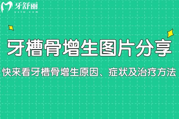 牙槽骨增生圖片分享:快來看牙槽骨增生原因、癥狀及治療方法
