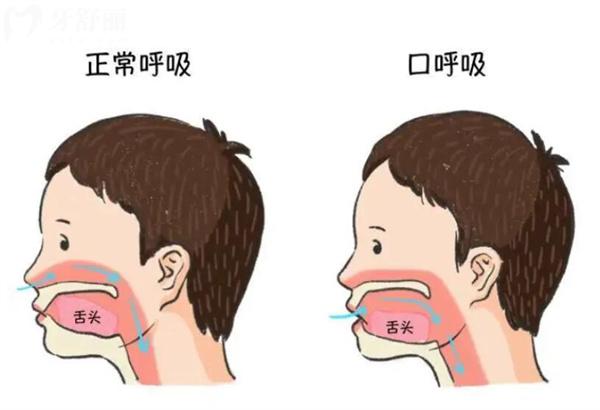 網(wǎng)紅封口貼引爭議：兒童口呼吸糾正不當，會致缺氧危機