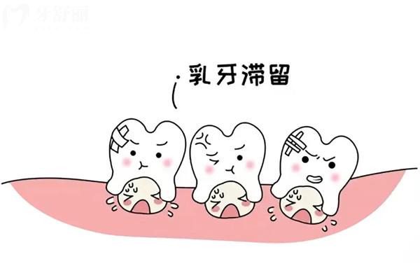 成人乳牙滯留能用一輩子嗎