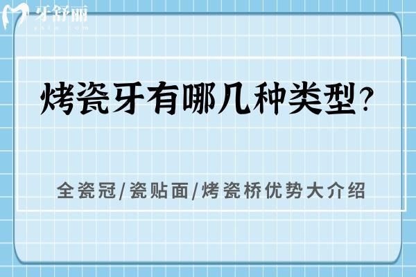 烤瓷牙有哪幾種類型？全瓷冠/瓷貼面/烤瓷橋優(yōu)勢大介紹