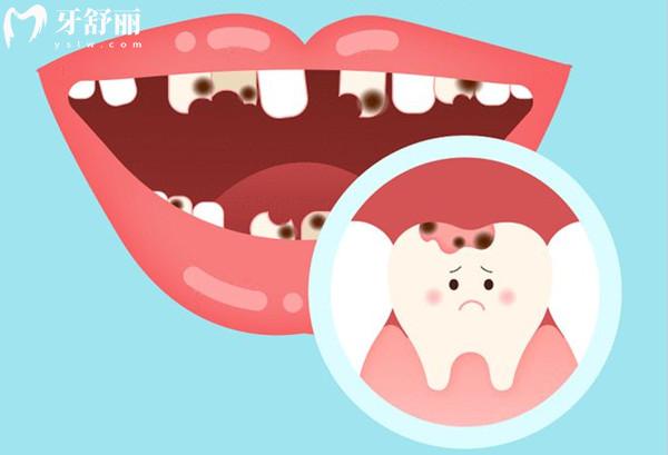 口腔不健康會(huì)引起哪些疾病