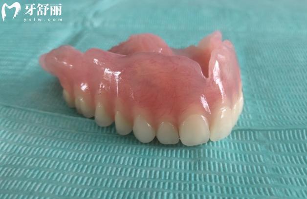吸附式假牙好不好