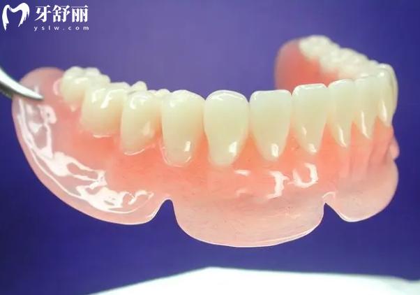吸附式假牙適合哪些人
