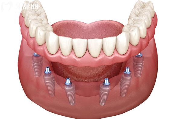 **附屬北**腔醫(yī)院收費標準