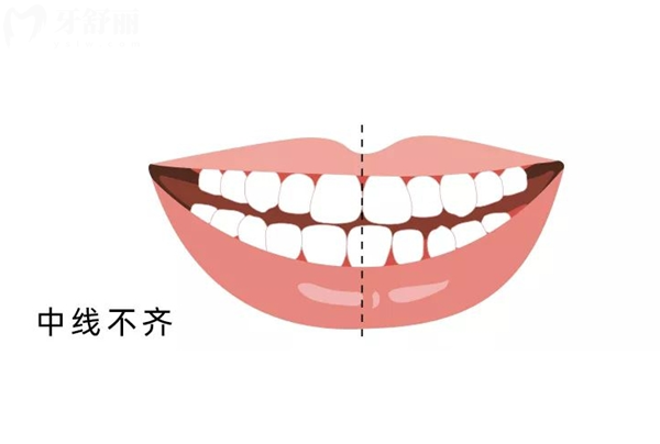 寧夏<span style=