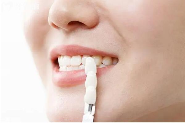 不同價格的牙齒美白有區(qū)別嗎