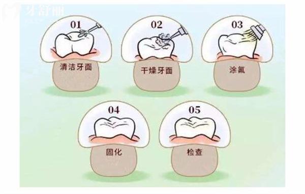 三歲以下嬰幼兒需要防蛀牙嗎?揭曉嬰幼兒如何預(yù)防蛀牙