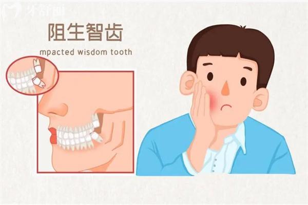 上海拔智齒多少錢(qián)一顆