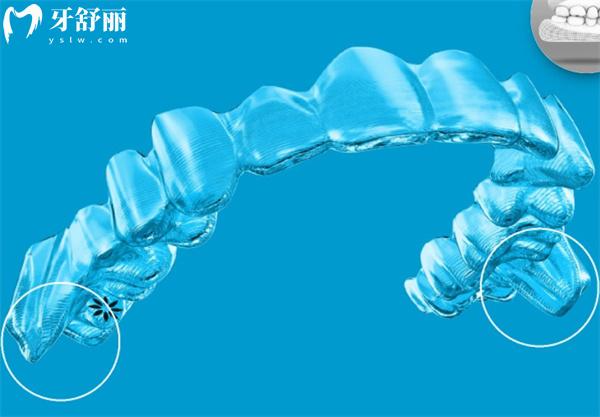 佳美口腔醫(yī)院牙齒矯正價格表