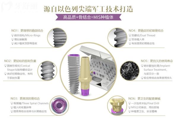 以色列mis種植體