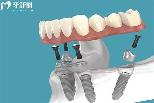 呼和浩特看牙哪家可以報(bào)<span style=