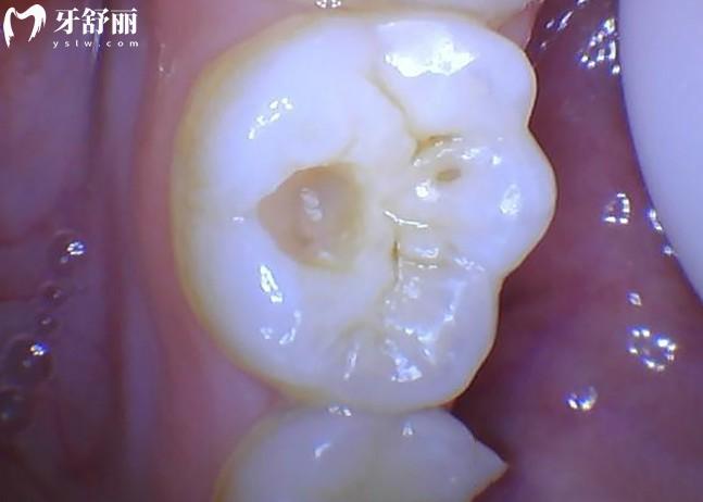 牙洞