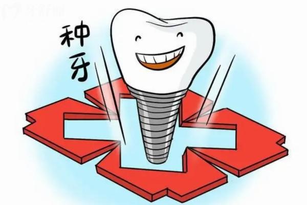 2024安徽牙科收費(fèi)標(biāo)準(zhǔn)新種牙4000+整牙8000+烤瓷牙800+麻溜看