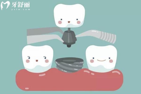 合肥排名前十的*牙科醫(yī)院有哪些?種牙/矯牙/根管治療技術(shù)靠譜可社保